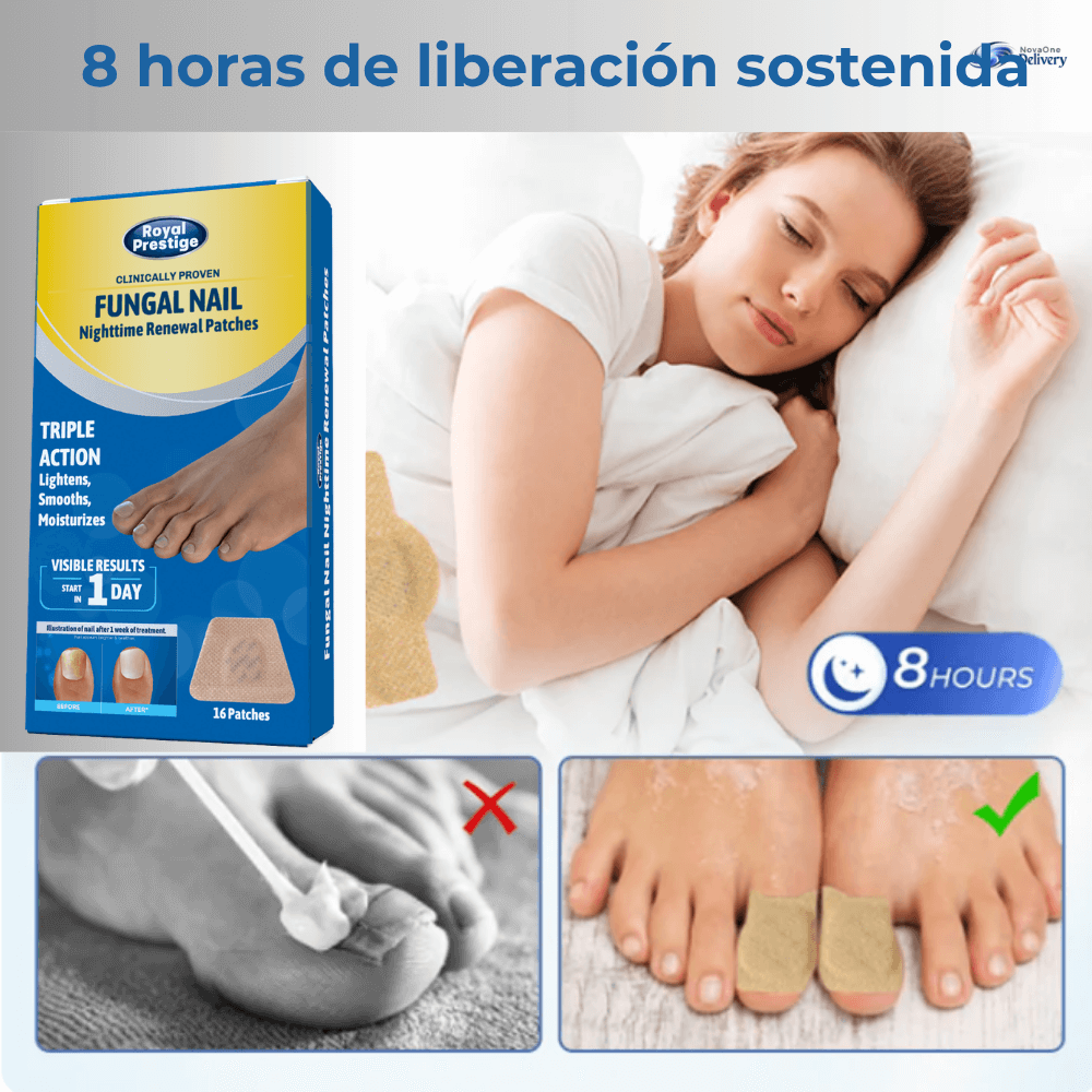 Fungal Nail Recupera el orgullo de mostrar tus pies